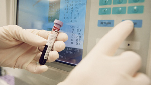 prueba-sangre-laboratorio